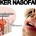 Definisi Lengkap Tentang Kanker Nasofaring